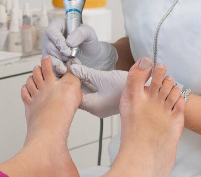 medische pedicure