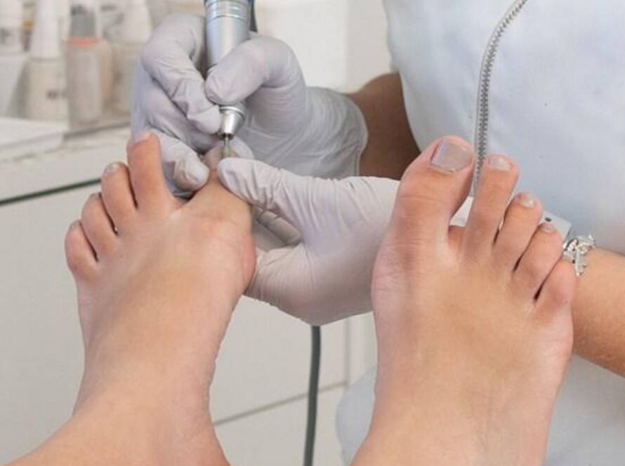 medische pedicure