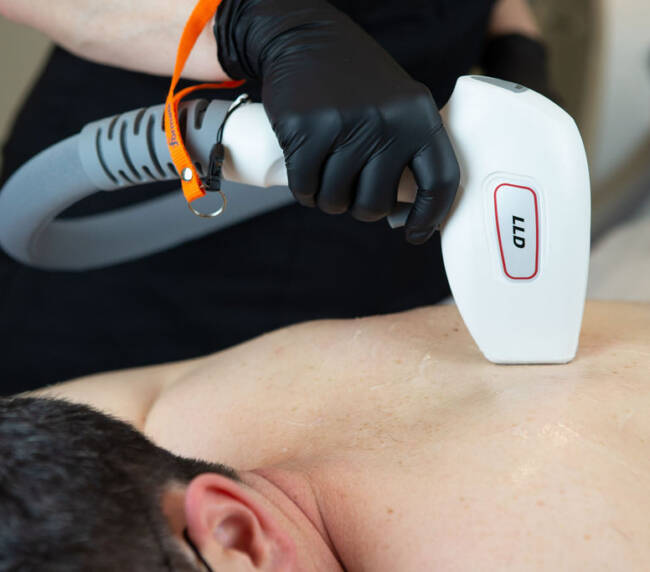 alphaderm behandeling
